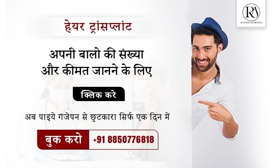 Offer1